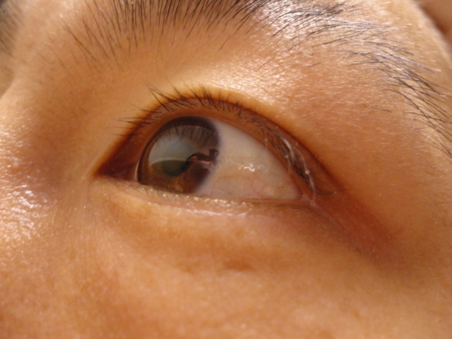 疲れ目の原因は目の筋肉痛